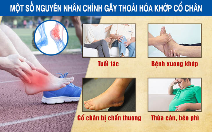 Một số nguyên nhân phổ biến gây thoái hóa khớp chân