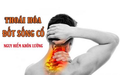 Thoái hóa đốt sống cổ theo quan niệm đông y là bệnh thuộc chứng tỳ