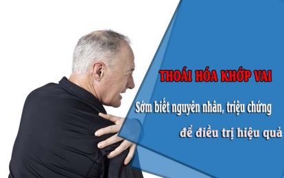 Thoai hoa khop vai là tình trạng sụn và xương dưới sụn của khớp vai bị hủy hoại, bào mòn