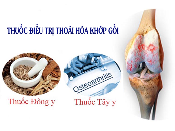 Thuốc điều trị được chỉ định khi tình trạng đau nhức khớp kéo dài, ảnh hưởng tới vận động