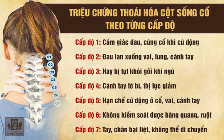 Triệu chứng của bệnh ở mỗi cấp độ sẽ có sự khác nhau