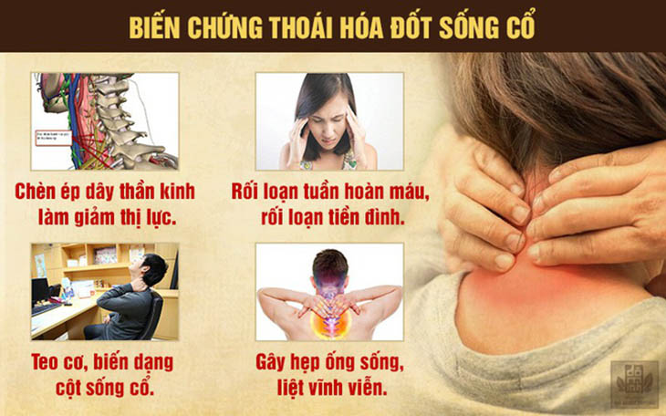 Bệnh có thể gây ra nhiều biến chứng nguy hiểm nếu không được điểu trị đúng cách