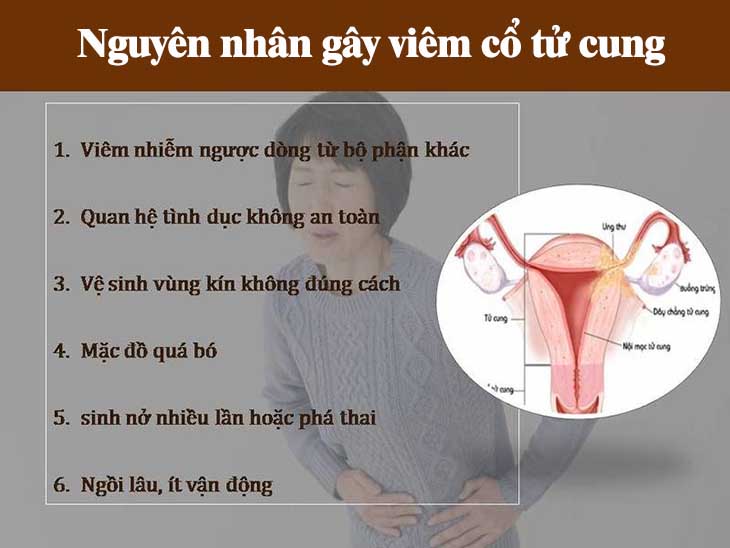 Các nguyên nhân phổ biến gây viêm cổ tử cung