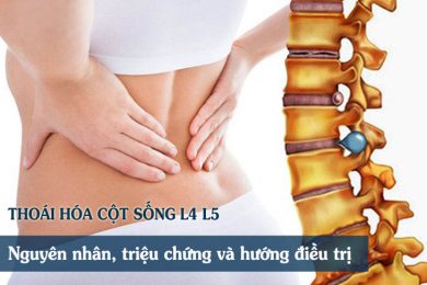 L4, L5 là các đốt sống nằm ở vị trí thấp nhất của thắt lưng