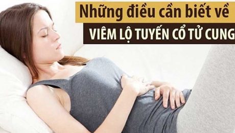 Viêm lộ tuyến cổ tử cung là bệnh lý xảy ra với 50 - 60% phụ nữ trong độ tuổi sinh sản