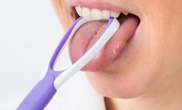 Vệ sinh khoang miệng không sạch sẽ là nguyên nhân dẫn tới tình trạng lưỡi trắng và nhạt miệng
