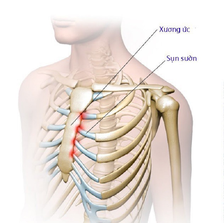 Khoang bụng là khu vực trên cơ thể tác động rất lớn đến vùng xương ức