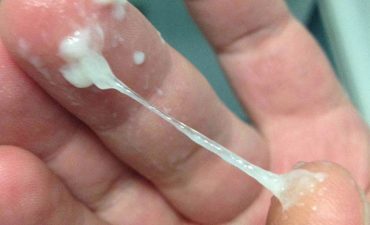 Ra nhiều khí hư là dấu hiệu nấm âm đạo