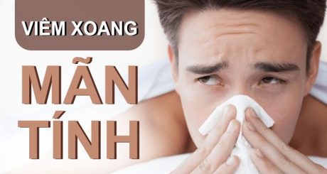 Viêm xoang mãn tính là một dạng của viêm xoang với các triệu chứng nghiêm trọng hơn