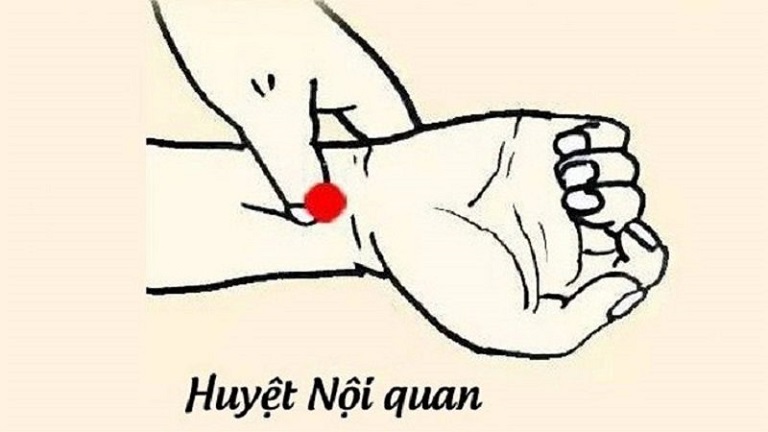 Bấm huyệt nội quan chữa bệnh xuất tinh sớm ở nam giới