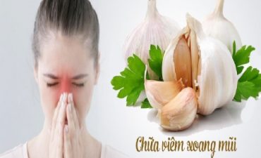 Top Các Cách Chữa Viêm Xoang Bằng Tỏi Bà Con Có Thể Áp Dụng Ngay