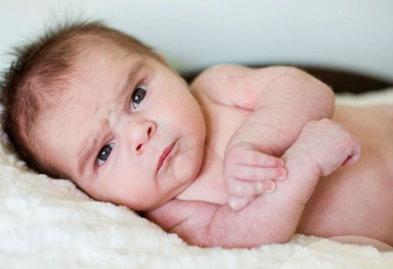 Mề đay cấp ở trẻ em có nguy hiểm không?