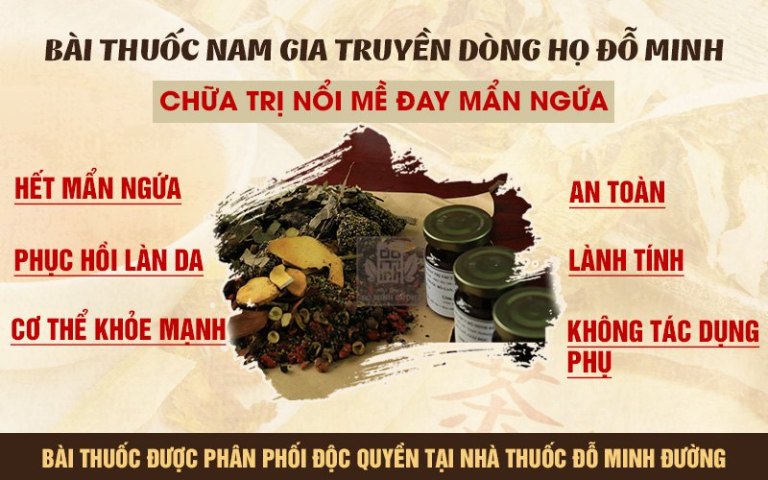 Nổi mề đay sau sinh uống thuốc gì?