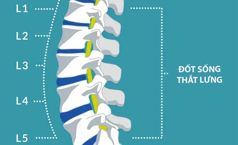 Thoát vị đĩa đệm L1 L2 là gì?