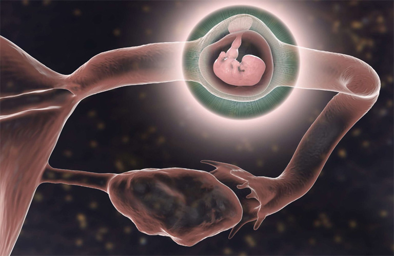 Mới Có Bầu Đau Bụng Dưới do mang thai ngoài tử cung 