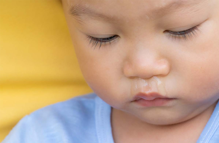 Trẻ bị sổ mũi là tình trạng phổ biến và dễ khắc phục