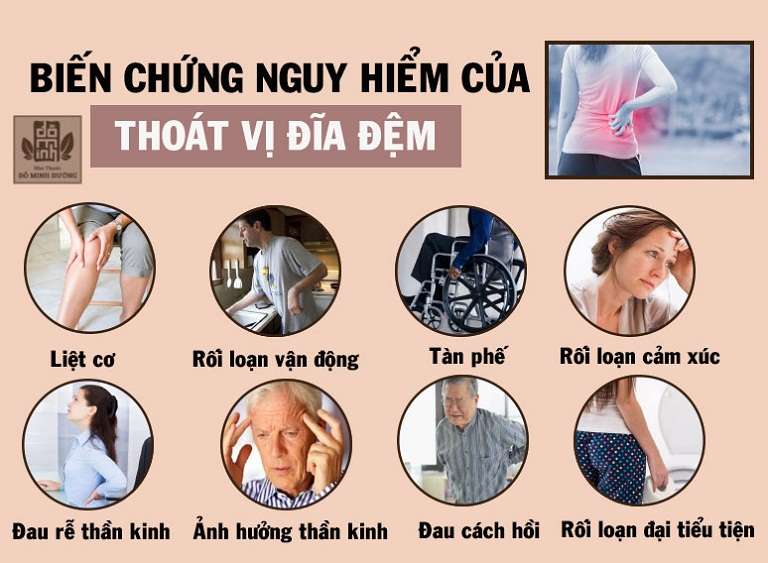 Biến chứng nguy hiểm bệnh thoát vị đĩa đệm