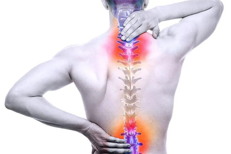 Thoát vị đĩa đệm cột sống