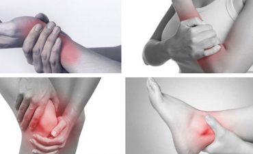 Bệnh viêm đa khớp có nguy hiểm nếu không được điều trị đúng cách và kịp thời