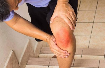 Cảm giác đau này thường xảy ra khi bạn phải di chuyển xuống các bậc thang