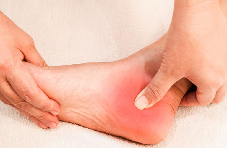 Viêm gân quanh khớp cổ chân có thể gây đau nhức mà không nhất thiết sưng tấy