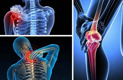 Đau nhức xương khớp toàn thân là tình trạng đau mỏi lan rộng ở khắp cơ thể