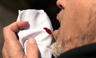 Ho ra máu là hiện tượng khi người bệnh trong quá trình ho có sự xuất hiện của máu trong đờm