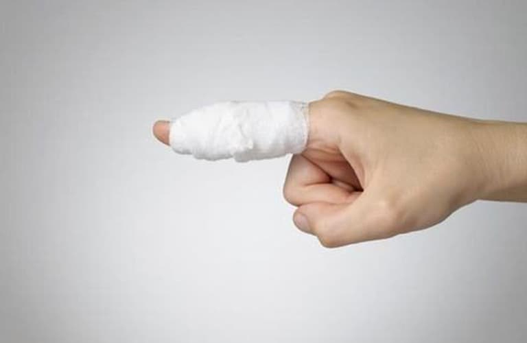 Các chấn thương như gãy xương, bong gân hay tai nạn cũng có thể khiến khớp ngón tay bị sưng