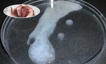 Tinh trùng vón cục có thể ảnh hưởng đến khả năng thụ thai