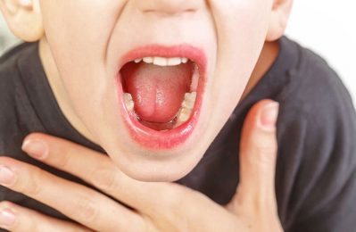 Viêm họng là một bệnh lý phổ biến ở trẻ em, xảy ra khi niêm mạc họng bị viêm