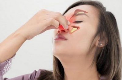 Viêm mũi dị ứng là tình trạng viêm niêm mạc mũi do phản ứng quá mức của hệ miễn dịch