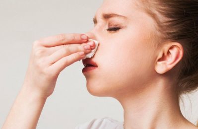 Viêm mũi xuất tiết là tình trạng viêm nhiễm niêm mạc mũi