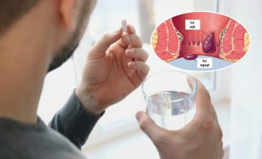Bệnh trĩ uống thuốc có thể khỏi trong một số trường hợp