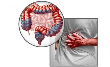 Đại tràng co thắt hay là một rối loạn mạn tính ở đường tiêu hóa mà không tìm thấy tổn thương thực thể nào khi nội soi
