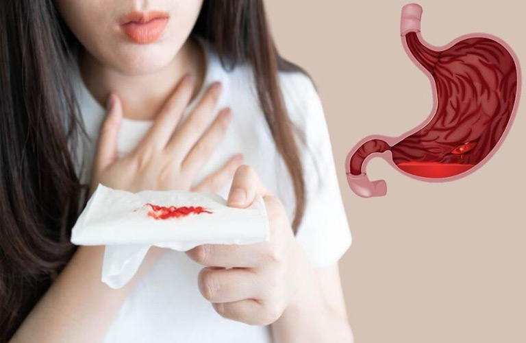 Đau bao tử nôn ra máu là tình trạng mà người bệnh bị đau ở vùng thượng vị