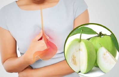 Người bị đau dạ dày có thể ăn ổi trong trường hợp dạ dày ổn định, không đau cấp