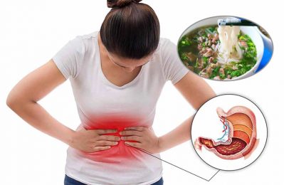 Đau dạ dày có thể ăn phở nhưng tùy vào đối tượng