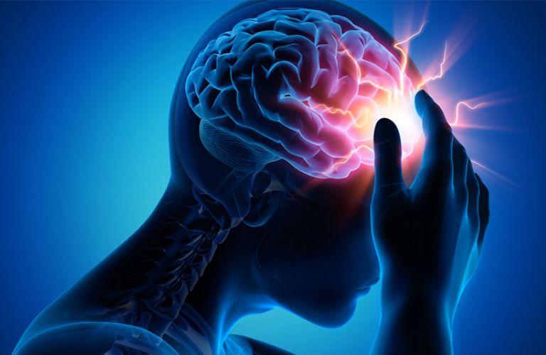 Giảm tuần hoàn máu lên não làm tăng nguy cơ tái phát cơn đau đầu