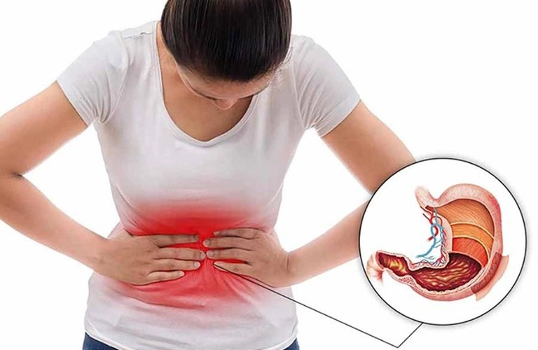 Các tổn thương niêm mạc dạ dày tạo ra cảm giác đau âm ỉ, nóng rát ở thượng vị, đôi khi lan ra sau lưng và gây tức ngực