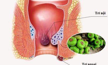 Tác dụng của quả sung chữa bệnh trĩ