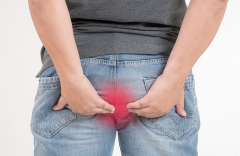 Nhiều bà con ban đầu tưởng chỉ là do ngồi nhiều hay nóng trong người, nhưng thực chất đây là dấu hiệu búi trĩ bắt đầu hình thành