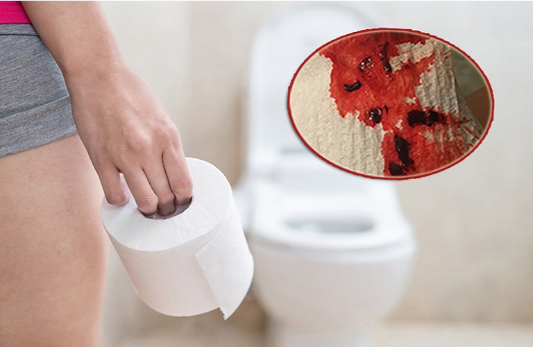 Lúc đầu chỉ là vệt máu nhỏ dính trên giấy vệ sinh, dễ bị bỏ qua hoặc nhầm lẫn với bệnh táo bón thông thường