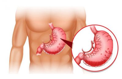 Vị trí đau dạ dày là một yếu tố quan trọng giúp bà con nhận biết được vấn đề mà dạ dày gặp phải
