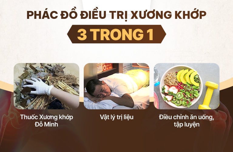 Phác đồ xương khớp của Đỗ Minh Đường